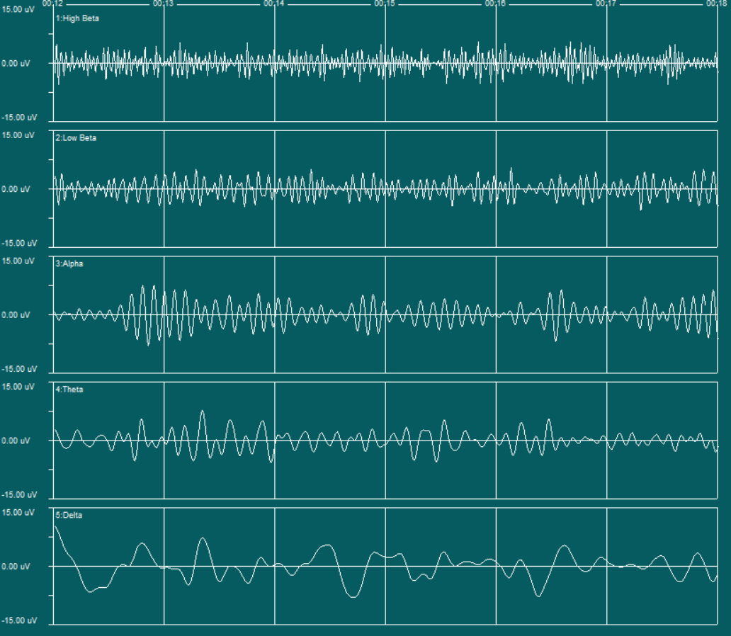 EEG readout showing Beta, Alpha, Theta, and Delta brainwave patterns