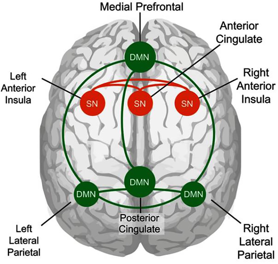 Illustration accompanying the discussion of the Default Mode Network