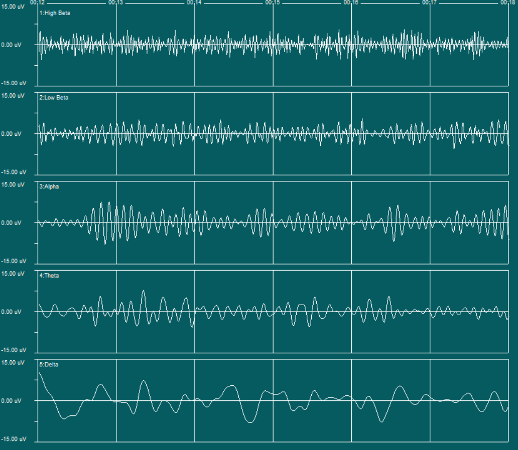 Image of primary brainwave designations: delta waves (bottom), theta, alpha, low beta, high beta (top)